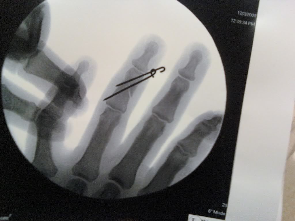 1203091404.jpg