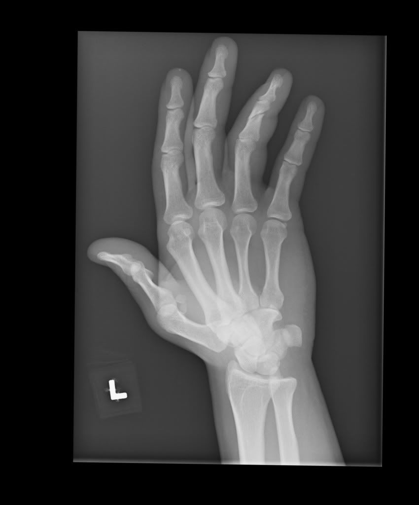 hand2.jpg