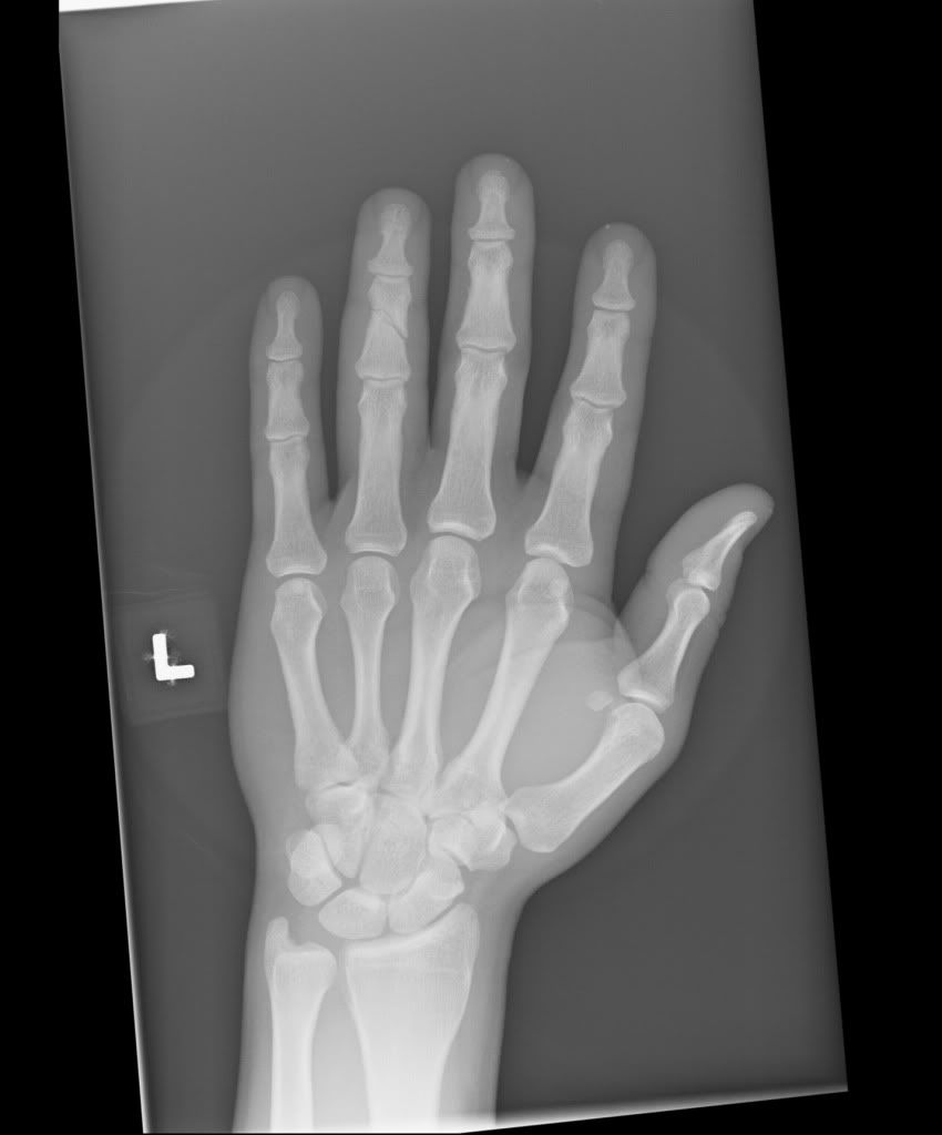 hand4.jpg