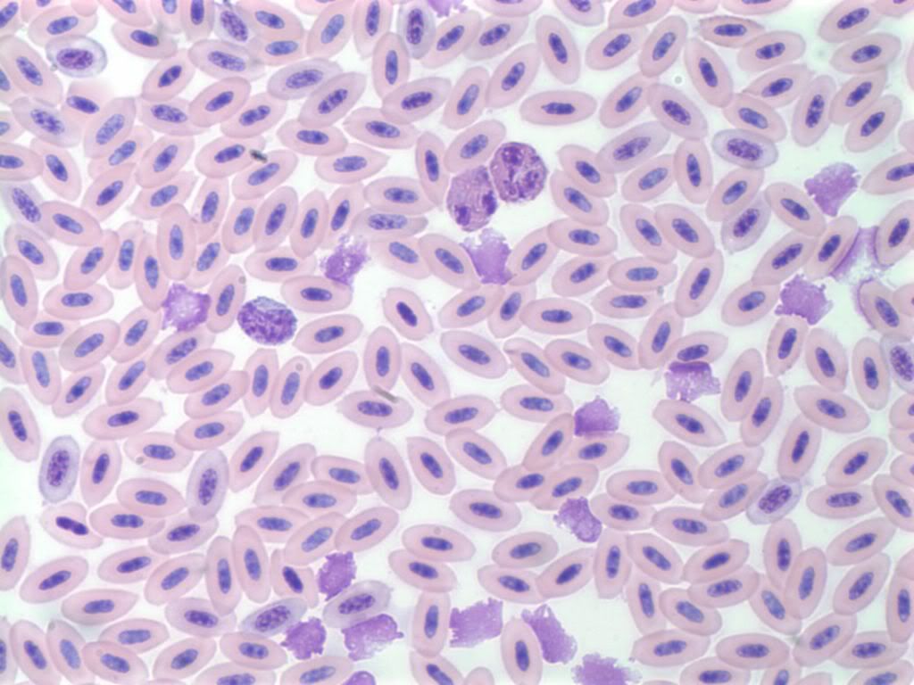 Monocyte And Lymphocyte