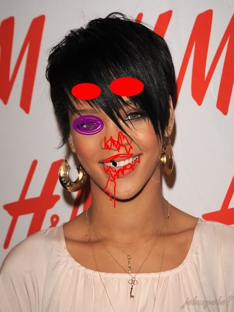 rihanna bruises from chris brown. Rihanna is believed to have
